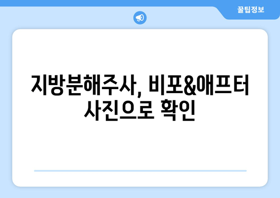 허벅지 지방분해주사 4회차 후기| 효과, 변화, 그리고 솔직한 후기 | 허벅지, 지방분해, 주사, 후기, 비포애프터, 가격, 부작용