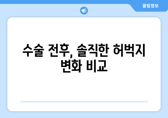 허벅지 지방 흡입, 가격 비용부터 출근 후기까지| 실제 경험 공유 | 허벅지 지방 흡입, 수술 후기, 출근, 가격 비용, 후기