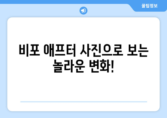 허벅지 지방 분해 주사 4회 경험 후기| 드디어 찾은 효과적인 다이어트 방법 | 허벅지 살, 지방 분해 주사, 후기, 비포 애프터, 효과, 가격