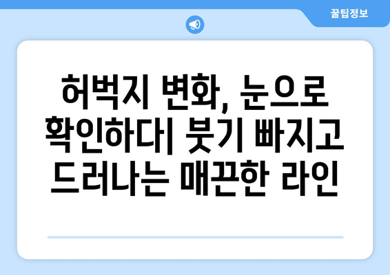 허벅지 지방흡입 후기| 여름철 압박복, 흉터 관리, 그리고 나의 변화 | 지방흡입 후기, 압박복, 흉터, 여름, 후기, 경험