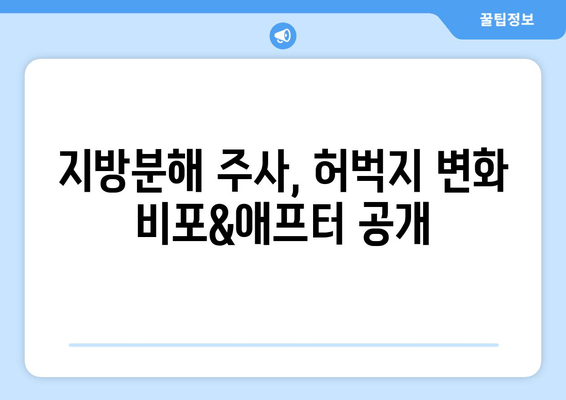 지방흡입 없이 지방분해 주사로 허벅지 둘레 줄인 실제 후기| -Xcm 감량 성공! | 허벅지, 지방분해주사, 비포애프터, 후기, 효과