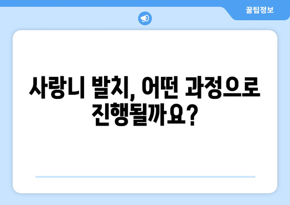 매복 사랑니 치료 전 꼭 알아야 할 5가지 필수 사항 | 사랑니 발치, 통증, 부작용, 치료 과정, 주의 사항