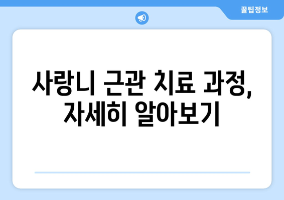 사랑니 근관 치료| 구강 건강 지키는 필수 정보 | 사랑니, 근관 치료, 치과, 통증 완화, 관리법