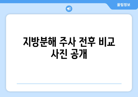 날씬한 허벅지를 위한 지방분해 주사 1회 후기| 실제 효과와 변화는? | 허벅지 지방, 지방분해 주사 후기, 비포애프터