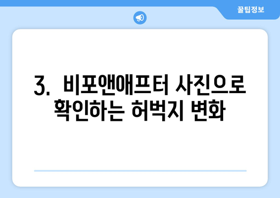 허벅지 지방, 4회 지방분해주사 후 확실히 달라졌어요! | 허벅지 지방 감소, 지방분해주사 후기, 비포앤애프터