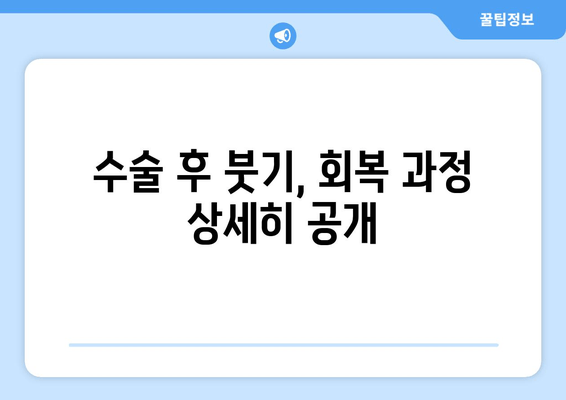 허벅지 지방흡입, 비용 & 출근 후기| 실제 경험 공유 | 허벅지 지방흡입 후기, 붓기, 회복, 부작용, 가격