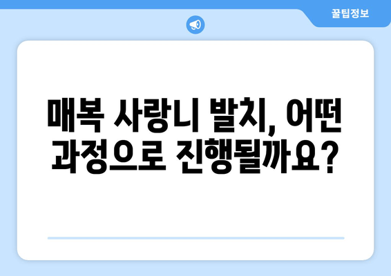 매복 사랑니 치료 전 꼭 확인해야 할 5가지 사항 | 사랑니 발치, 치과 상담, 치료 과정