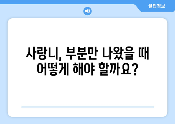 부분 맹출 사랑니, 이렇게 대처하세요! | 사랑니 통증, 사랑니 붓기, 사랑니 발치, 사랑니 관리