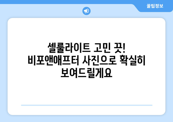 허벅지 셀룰라이트 고민? 지방 흡입 없이 주사로 둘레 줄인 후기 | 셀룰라이트, 허벅지, 주사 시술, 비포애프터, 후기