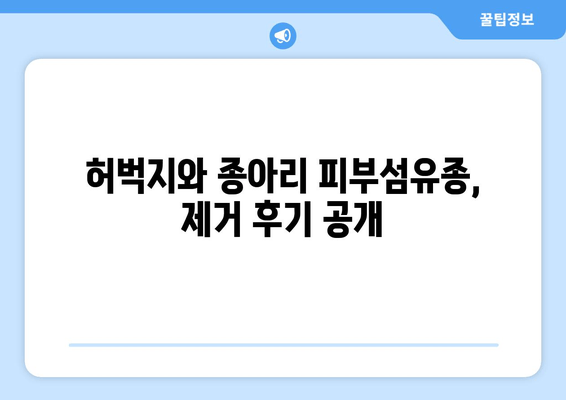 허벅지 & 종아리 피부섬유종 제거 후기| 보험 적용 가능할까요? | 피부섬유종, 제거 수술, 보험, 비용, 후기