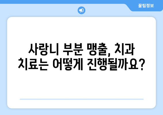 사랑니 부분 맹출, 어떻게 해야 할까요? | 사랑니, 부분 맹출, 대처 방법, 치과, 통증